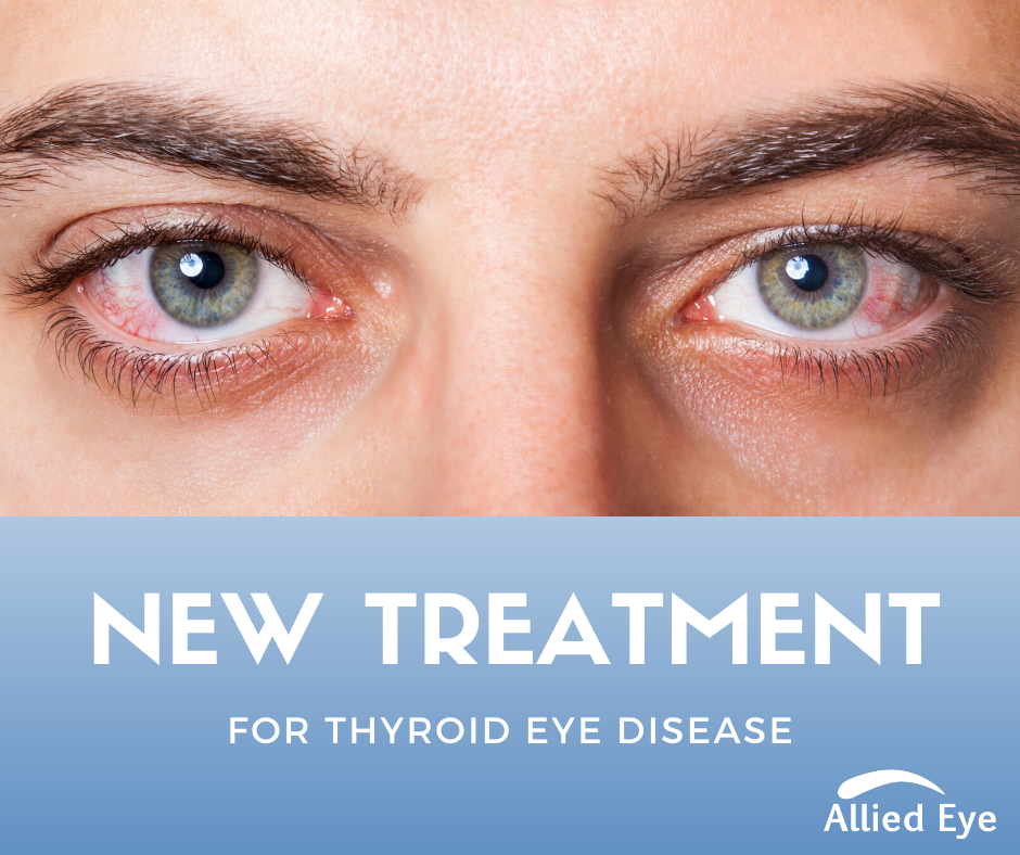 New Treatment For Thyroid Eye Disease 5975